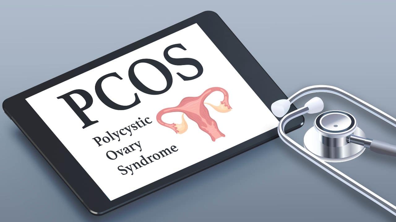 Polycystic Ovary Syndrome